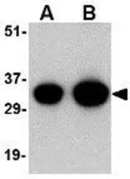 Anti-NIPSNAP antibody used in Western Blot (WB). GTX85407