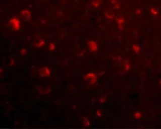 Anti-SLITRK6 antibody used in IHC (Paraffin sections) (IHC-P). GTX85411