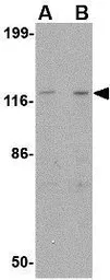 Anti-Slitrk3 antibody used in Western Blot (WB). GTX85417