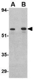 Anti-Plxdc2 antibody used in Western Blot (WB). GTX85419
