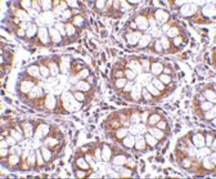 Anti-TEM1 antibody used in IHC (Paraffin sections) (IHC-P). GTX85430
