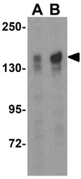 Anti-TBC1D1 antibody used in Western Blot (WB). GTX85437