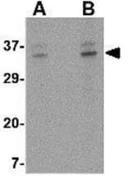 Anti-ORAI3 antibody used in Western Blot (WB). GTX85438