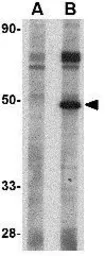 Anti-CRLF2 antibody used in Western Blot (WB). GTX85439