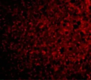 Anti-CRLF2 antibody used in IHC (Paraffin sections) (IHC-P). GTX85439