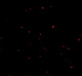 Anti-ORAI2 antibody used in Immunocytochemistry/ Immunofluorescence (ICC/IF). GTX85443
