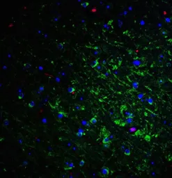 Anti-Nogo A antibody used in IHC (Paraffin sections) (IHC-P). GTX85447