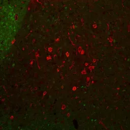 Anti-Choline Acetyltransferase antibody used in IHC (Paraffin sections) (IHC-P). GTX85450