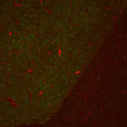 Anti-Choline Acetyltransferase antibody used in IHC (Paraffin sections) (IHC-P). GTX85450