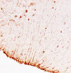 Anti-GFAP antibody used in Immunohistochemistry (IHC). GTX85454