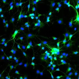 Anti-MAP2 antibody used in Immunocytochemistry/ Immunofluorescence (ICC/IF). GTX85455