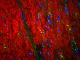Anti-Myelin basic protein antibody used in Immunohistochemistry (IHC). GTX85456