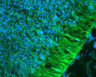 Anti-Nestin antibody used in Immunohistochemistry (IHC). GTX85457