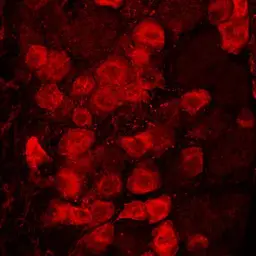 Anti-Prostatic Acid Phosphatase antibody used in IHC (Frozen sections) (IHC-Fr). GTX85463
