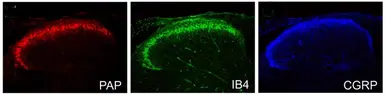 Anti-Prostatic Acid Phosphatase antibody used in IHC (Paraffin sections) (IHC-P). GTX85463