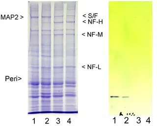 Anti-Peripherin antibody used in Western Blot (WB). GTX85464