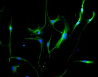 Anti-Vimentin antibody used in Immunohistochemistry (IHC). GTX85471