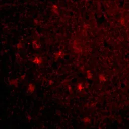 Anti-VISA antibody used in IHC (Paraffin sections) (IHC-P). GTX85481