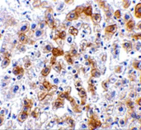 Anti-SCO2 antibody used in IHC (Paraffin sections) (IHC-P). GTX85482