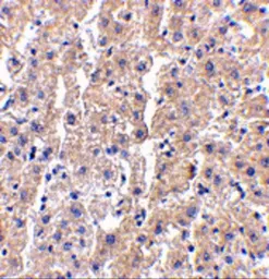 Anti-DRAM antibody used in IHC (Paraffin sections) (IHC-P). GTX85483