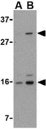 Anti-DRAM antibody used in Western Blot (WB). GTX85484