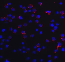 Anti-DDX58 antibody used in Immunocytochemistry/ Immunofluorescence (ICC/IF). GTX85488