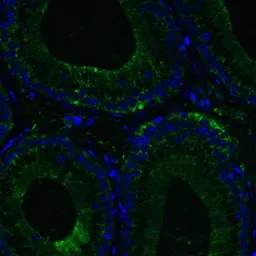 Anti-DDX58 antibody used in IHC (Paraffin sections) (IHC-P). GTX85488