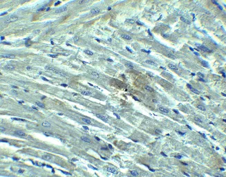 Anti-DDX58 antibody used in IHC (Paraffin sections) (IHC-P). GTX85488