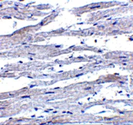 Anti-DDX58 antibody used in IHC (Paraffin sections) (IHC-P). GTX85488