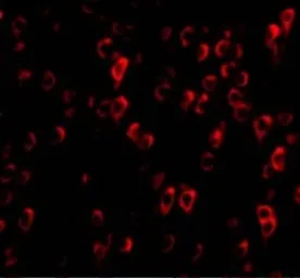 Anti-CTRP4 antibody used in Immunocytochemistry/ Immunofluorescence (ICC/IF). GTX85504