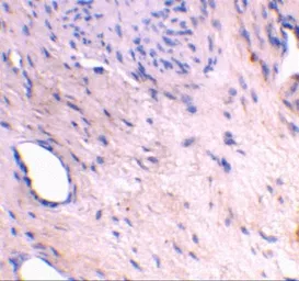Anti-ARMER antibody used in IHC (Paraffin sections) (IHC-P). GTX85516