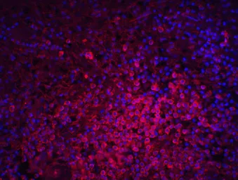 Anti-MD2 antibody used in IHC (Paraffin sections) (IHC-P). GTX85517
