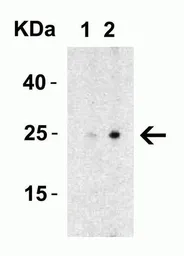 Anti-MD2 antibody used in Western Blot (WB). GTX85517