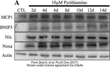 Anti-Noxa antibody used in Western Blot (WB). GTX85521