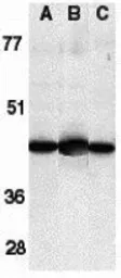 Anti-Caspase 13 antibody used in Western Blot (WB). GTX85523