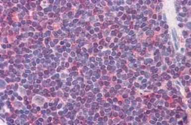 Anti-IL7 Receptor alpha (phospho Tyr449) antibody used in IHC (Paraffin sections) (IHC-P). GTX85604