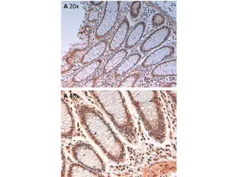 Anti-Aurora B (phospho Thr232) antibody used in IHC (Paraffin sections) (IHC-P). GTX85607