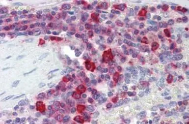 Anti-PIM3 antibody used in IHC (Paraffin sections) (IHC-P). GTX85641