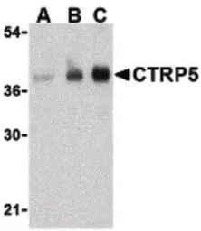 Anti-CTRP5 antibody used in Western Blot (WB). GTX85670