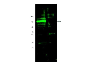 Anti-HIF3 alpha antibody used in Western Blot (WB). GTX85702