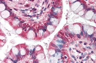 Anti-NRM antibody used in IHC (Paraffin sections) (IHC-P). GTX85768