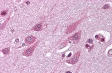 Anti-TMP21 antibody used in IHC (Paraffin sections) (IHC-P). GTX85769