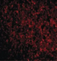 Anti-TMP21 antibody used in IHC (Paraffin sections) (IHC-P). GTX85770