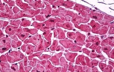 Anti-Podoplanin antibody [5E2] used in IHC (Paraffin sections) (IHC-P). GTX85772