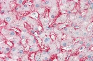Anti-GLUT2 antibody [199017] used in IHC (Paraffin sections) (IHC-P). GTX85825