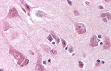 Anti-Noxa antibody used in IHC (Paraffin sections) (IHC-P). GTX85836