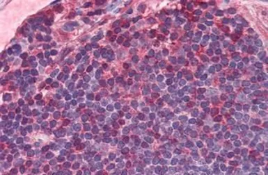 Anti-IL7 Receptor alpha antibody used in IHC (Paraffin sections) (IHC-P). GTX85865