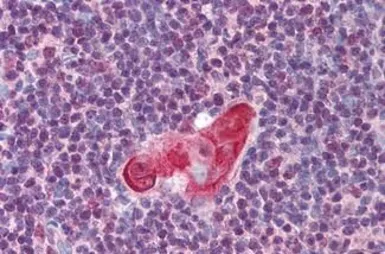 Anti-TLX1 antibody used in IHC (Paraffin sections) (IHC-P). GTX85867