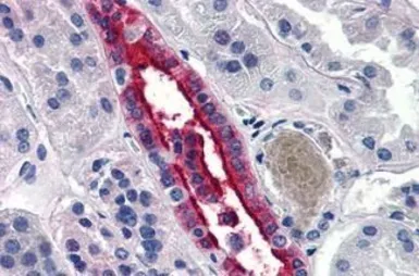 Anti-Aquaporin 2 antibody used in IHC (Paraffin sections) (IHC-P). GTX85895