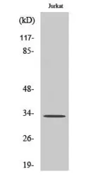 Anti-Cathepsin A (cleaved Arg326) antibody used in Western Blot (WB). GTX86895